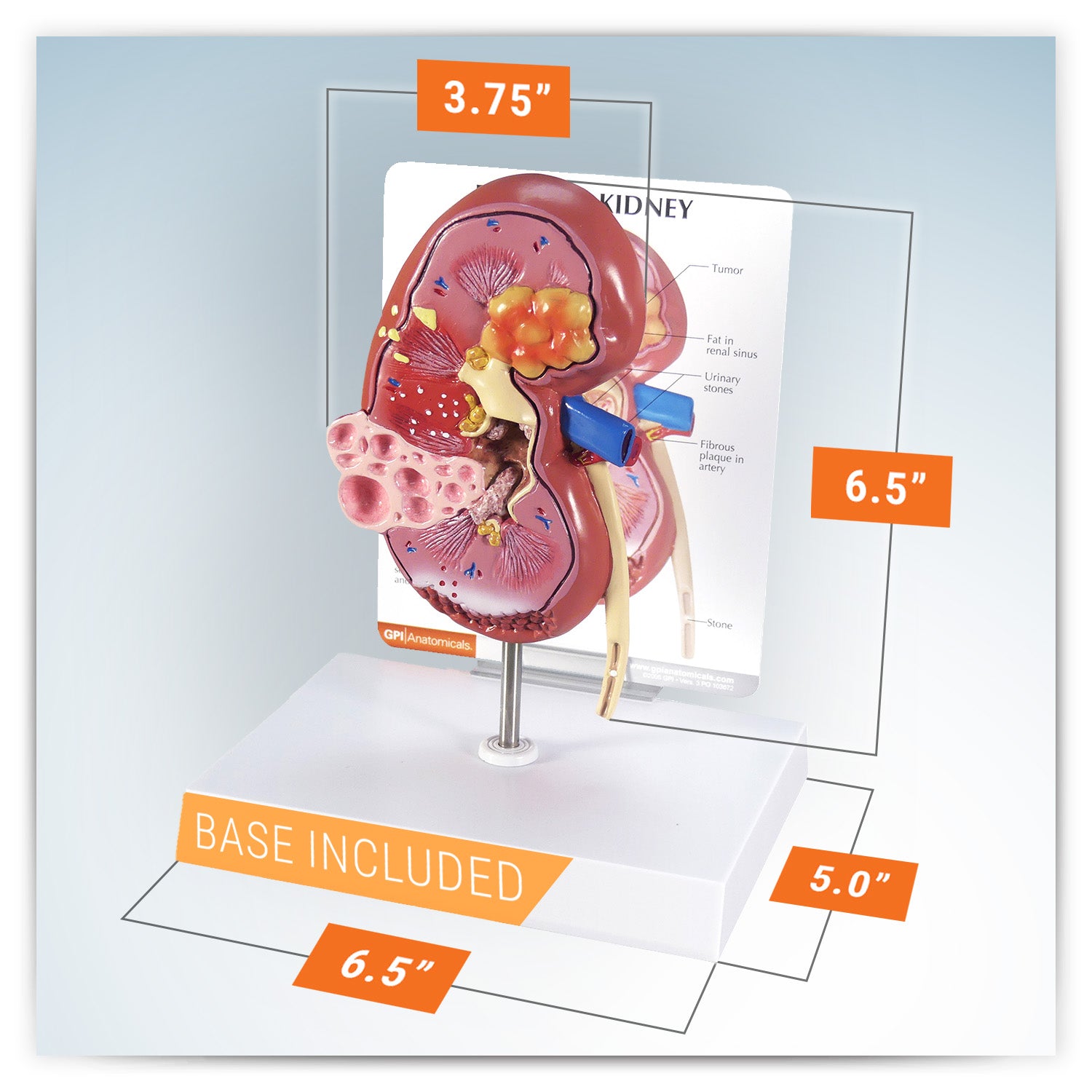 Kidney (Normal/Pathologies)
