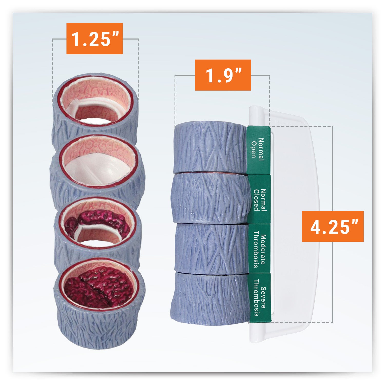 4-Piece Vein model