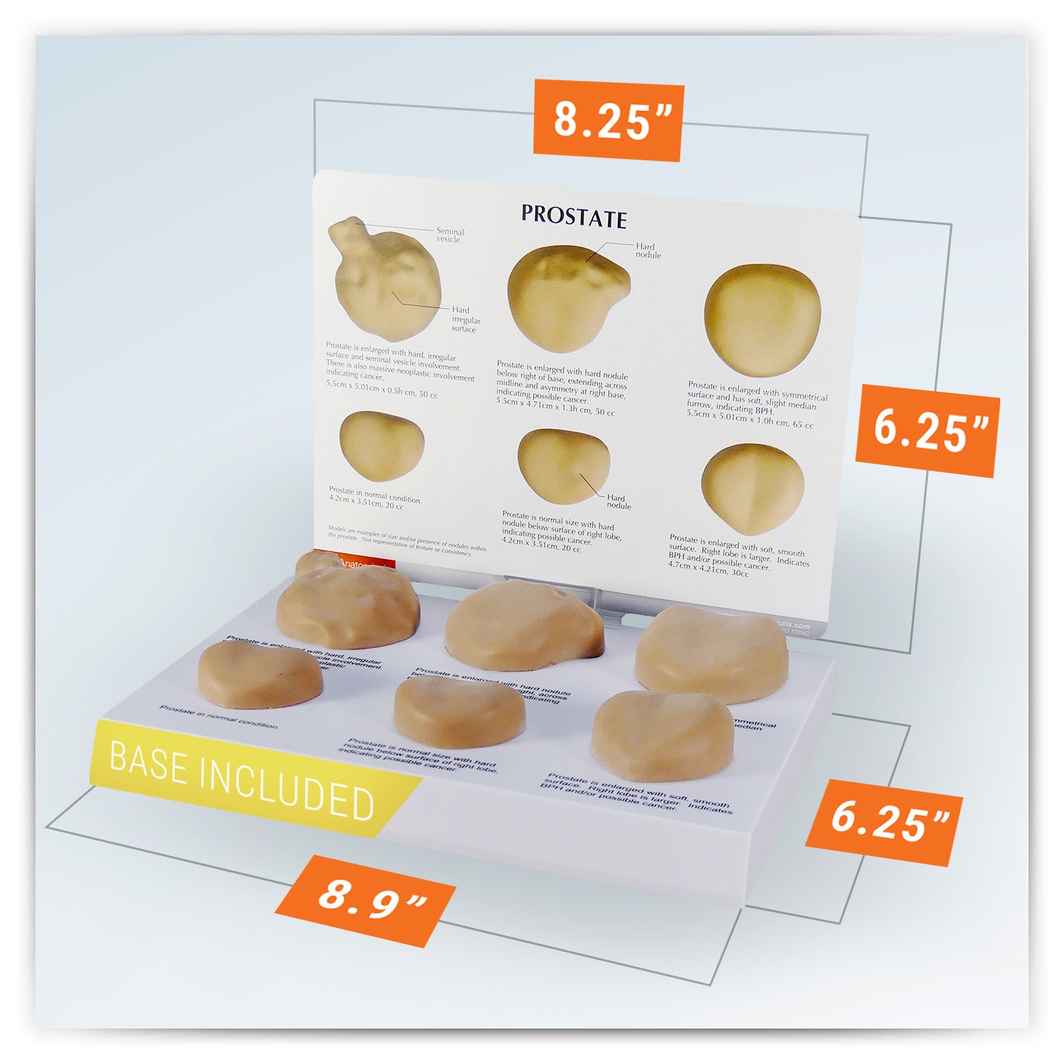 Prostate model set