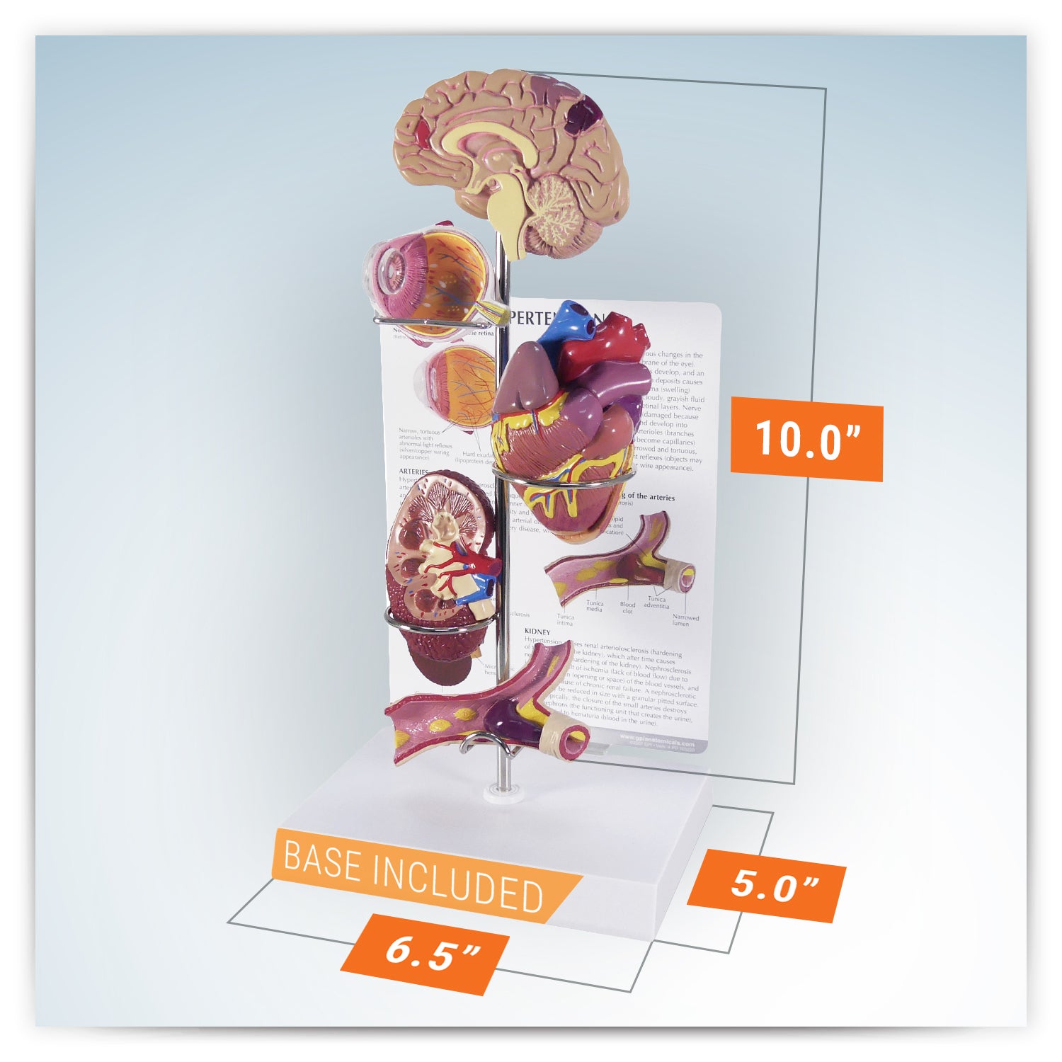 Hypertension Set (5x)