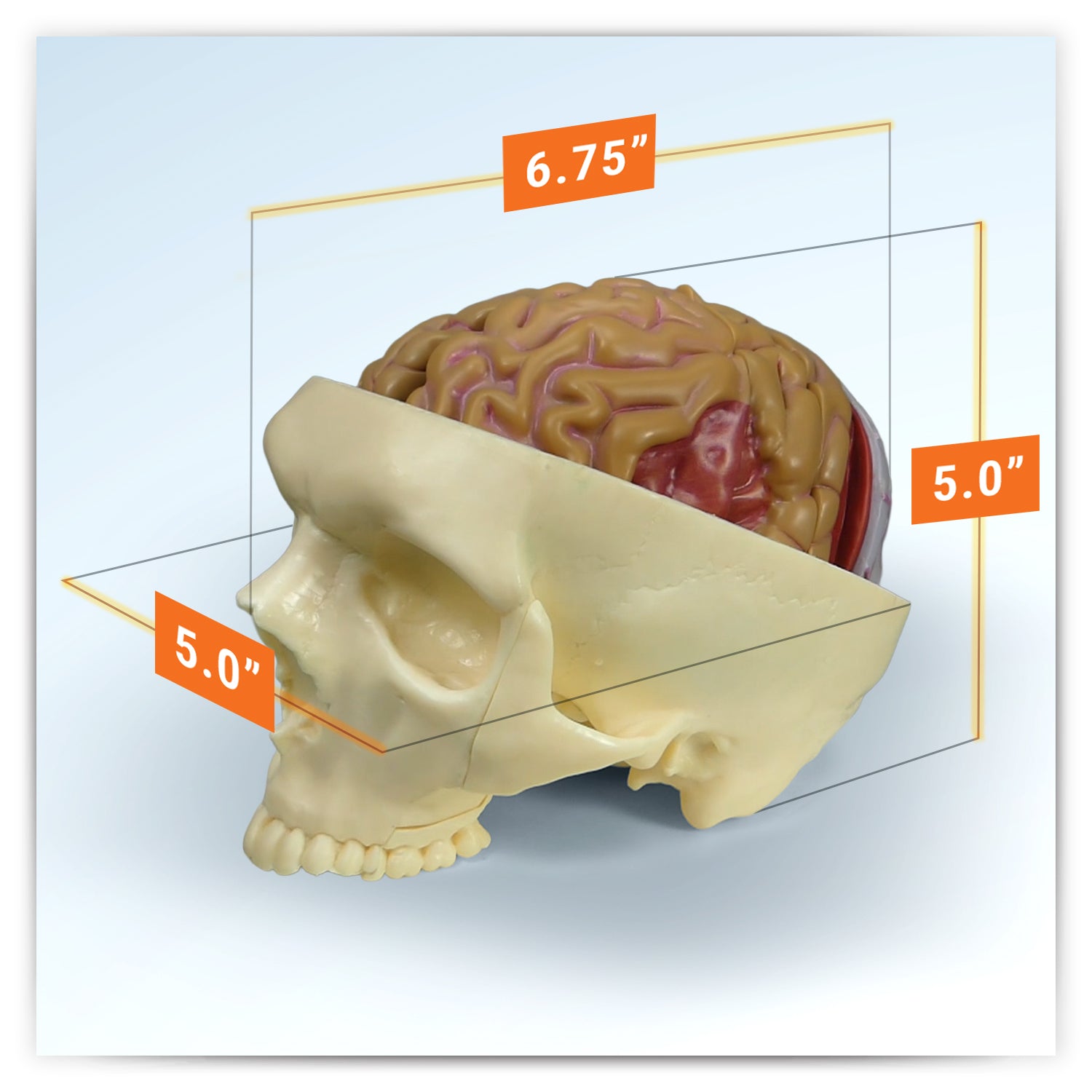 Brain in Base of Skull