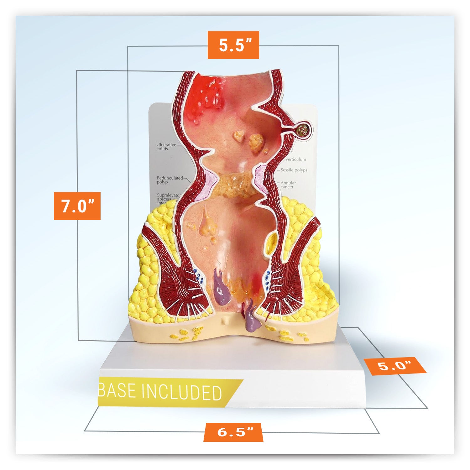 Rectum