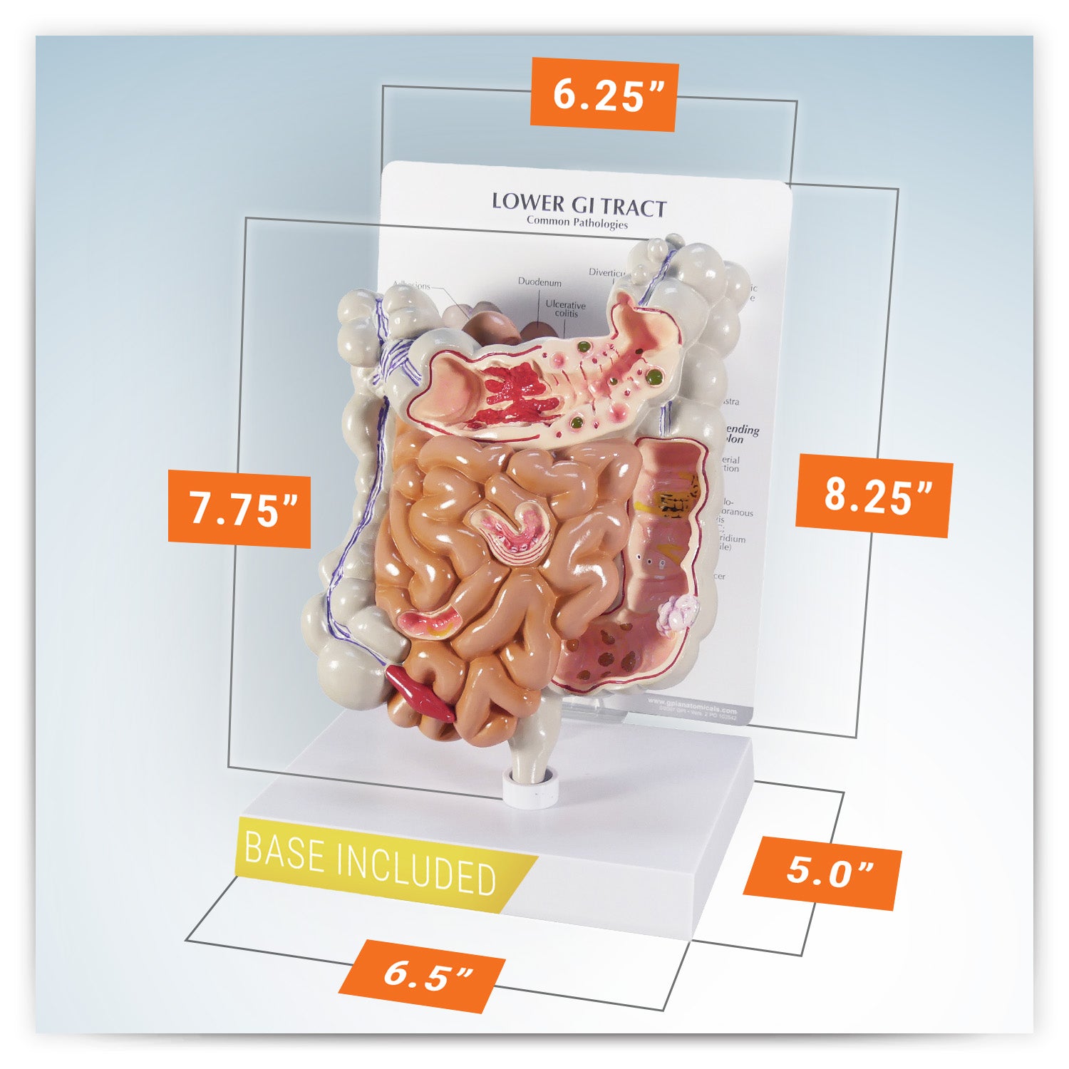 GI Tract