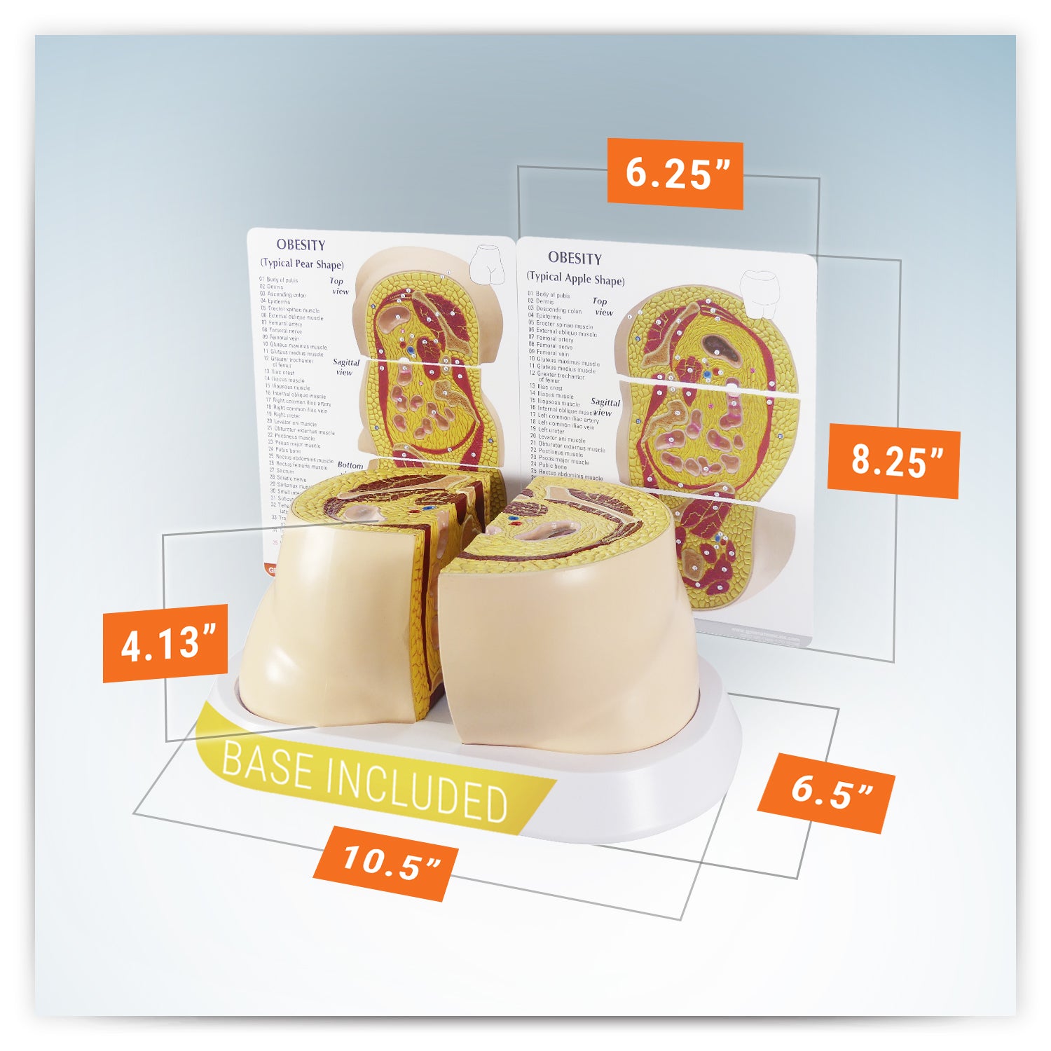 Obesity model