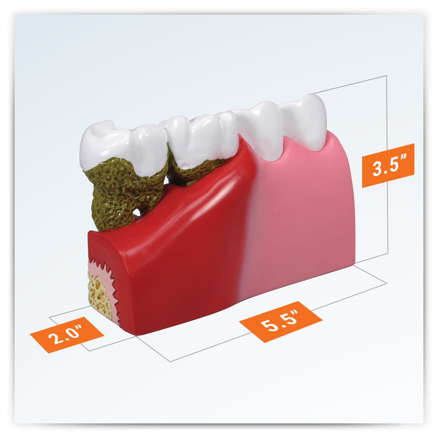 Teeth (Healthy/Pathologies)