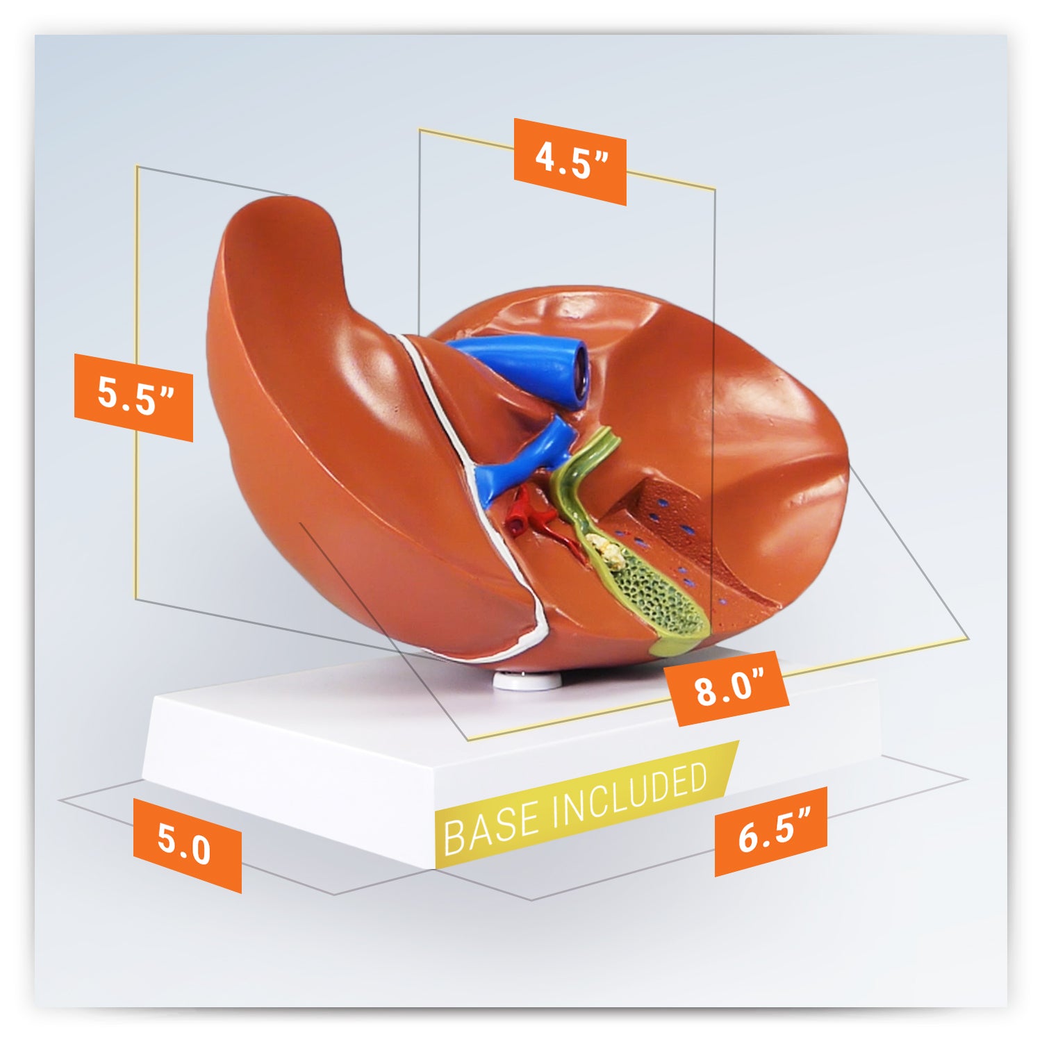 Liver/Gallbladder (with Gallstones)