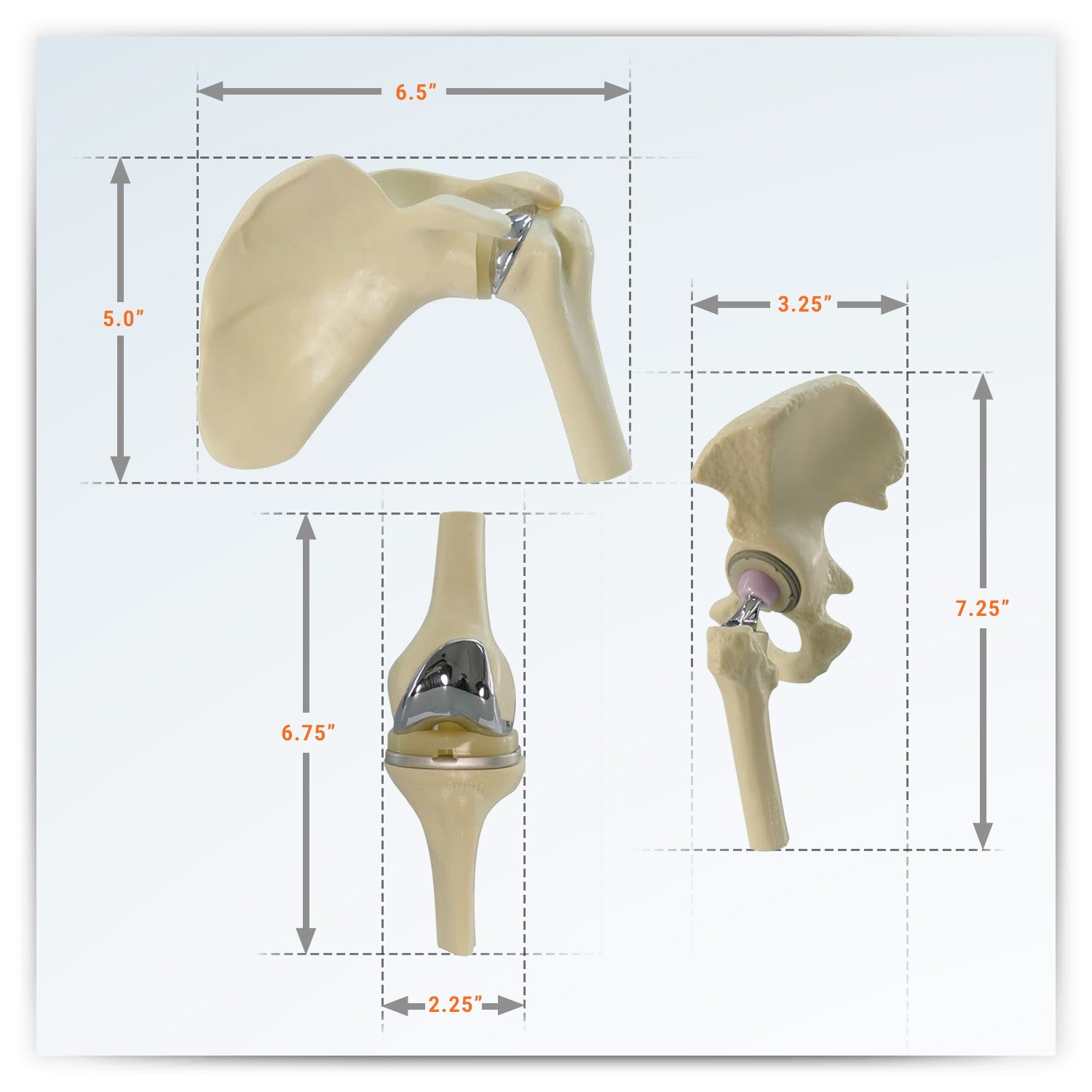 Mini-Implant Joint Set (NEW! Model)