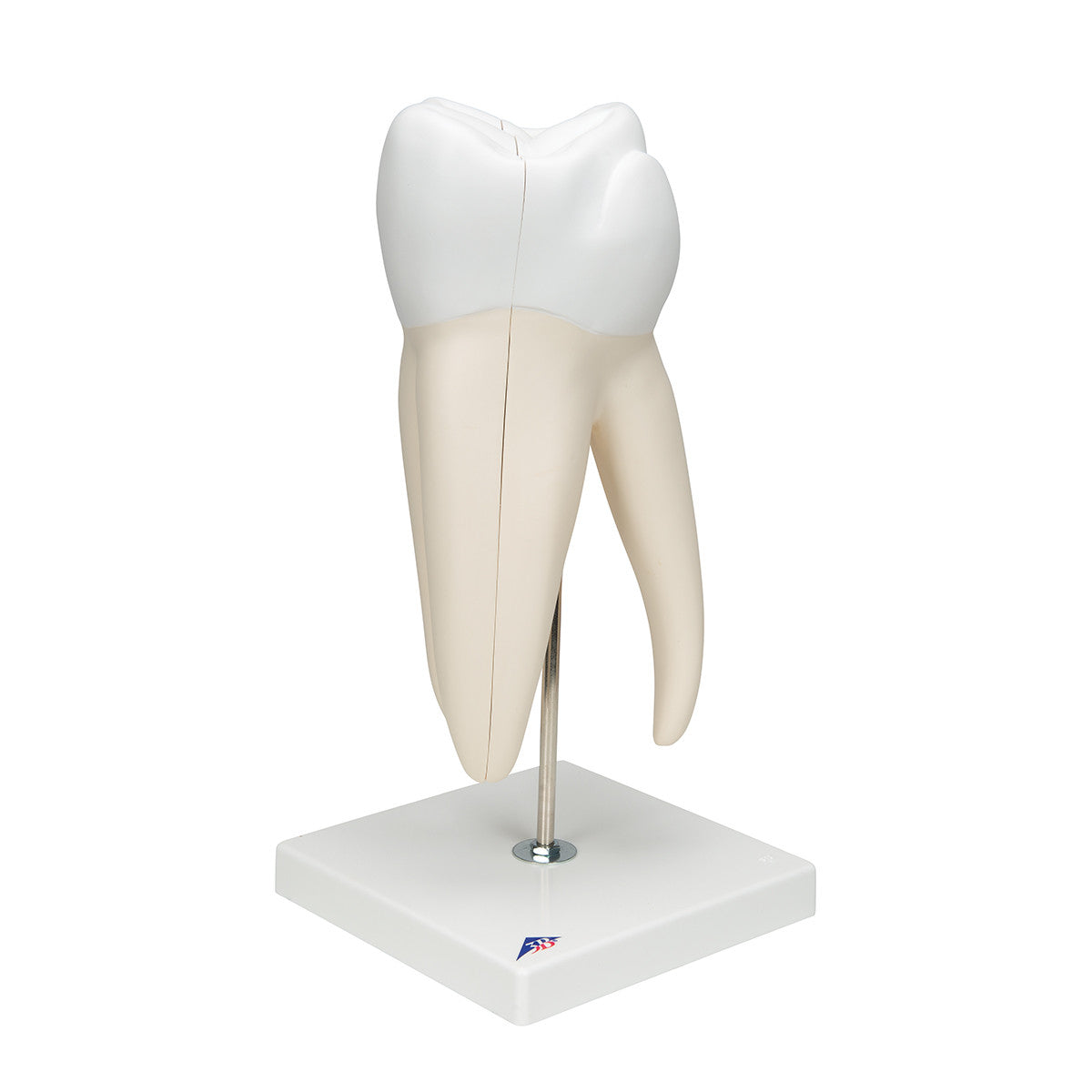 Giant Molar with Dental Cavities Human Tooth Model, 15 times Life-Size, 6 part