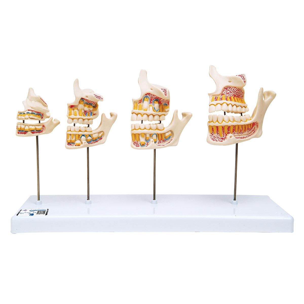 Dentition Development Model - 3B Scientific D20, view 2