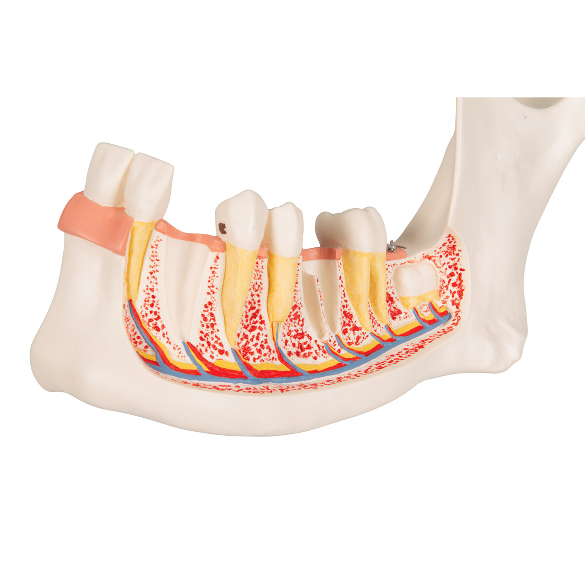 Half Lower Human Jaw Model, 3 times Full-Size, 6 part