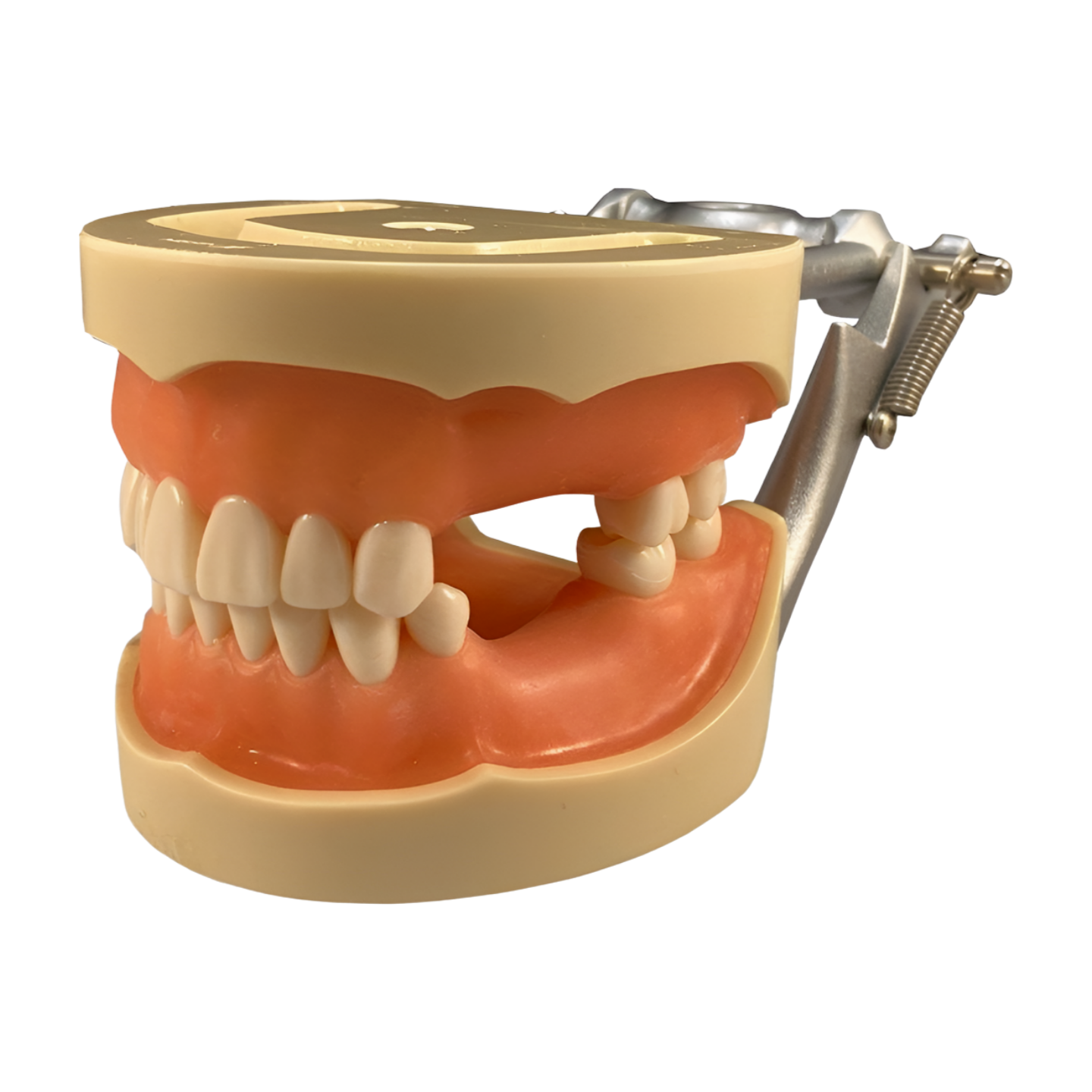D95SDP-MAU.2 partially edentulous impression model with DP articulator — Kilgore 200 Series prosthodontic training model