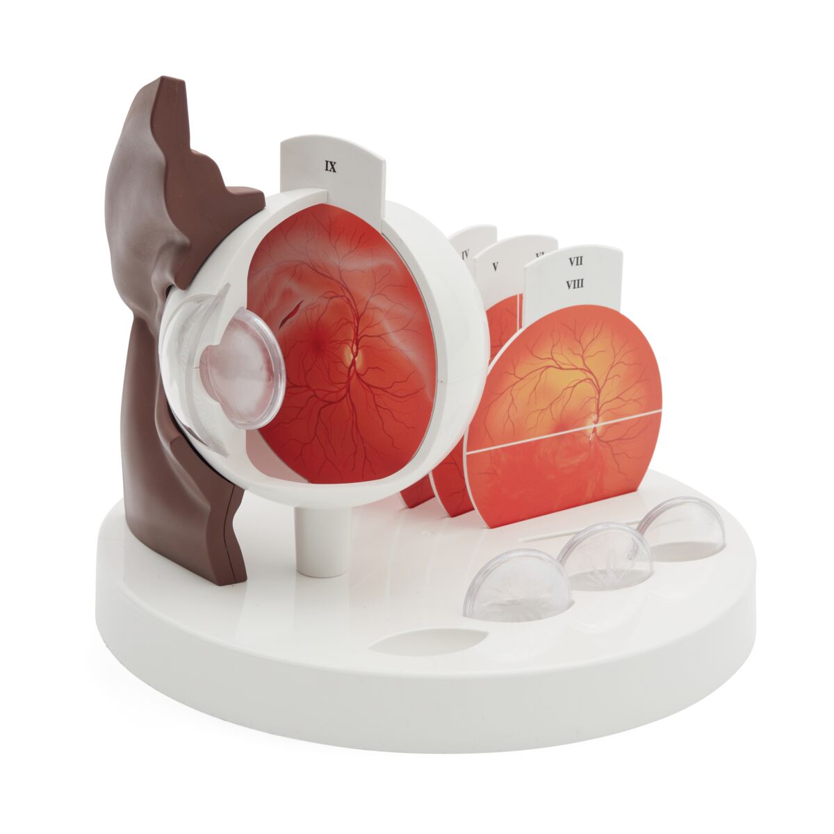 Pathological Human Eye Model, dark skin