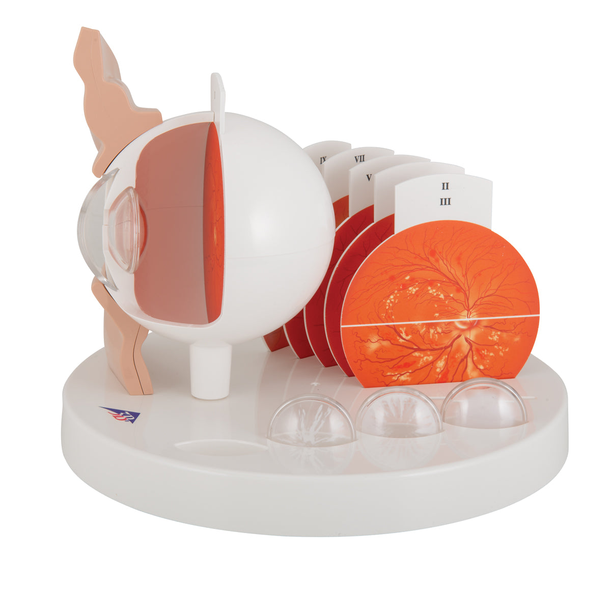 Pathological Human Eye Model