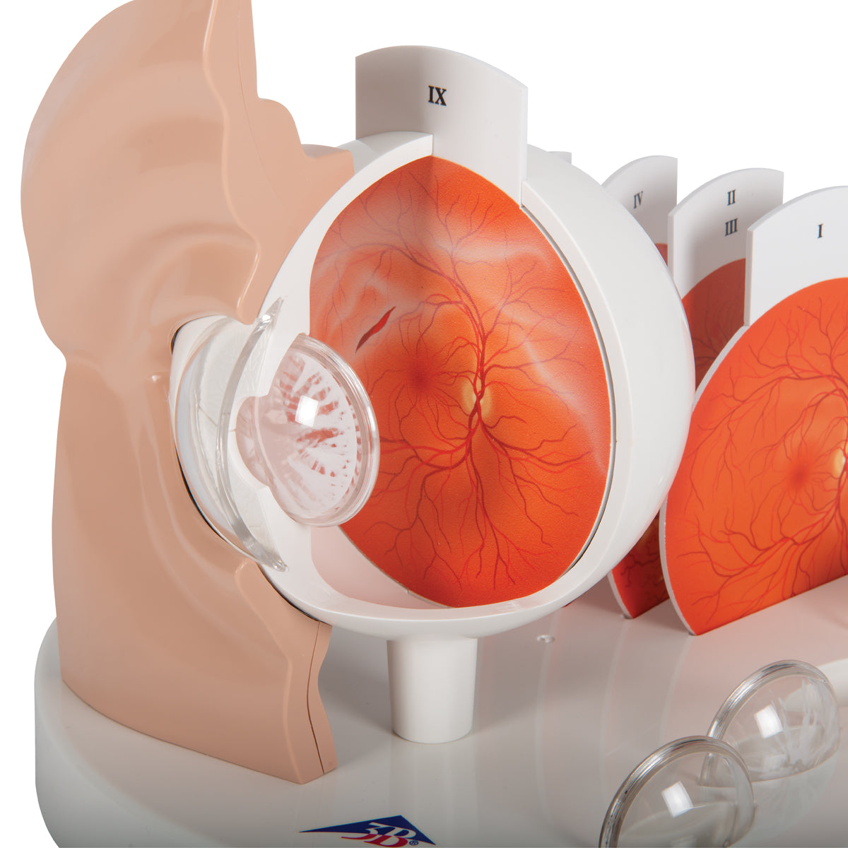 Pathological Human Eye Model