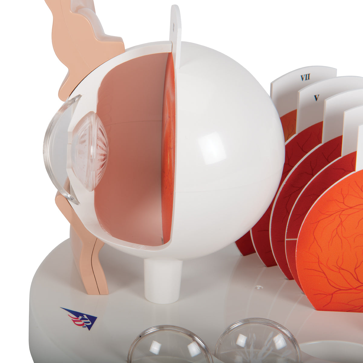 Pathological Human Eye Model