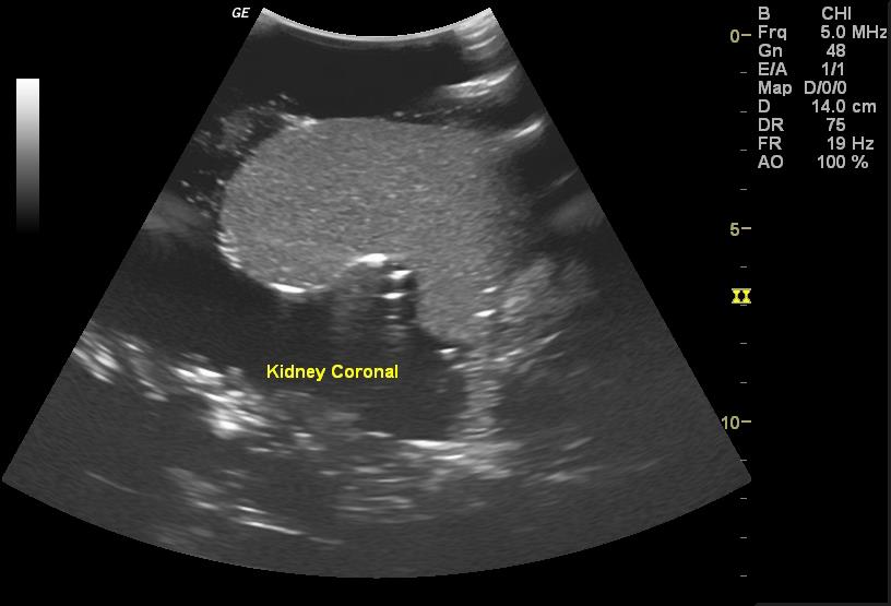 Adult Torso for X-Ray CT and US - Erler-Zimmer FLU02, view 11