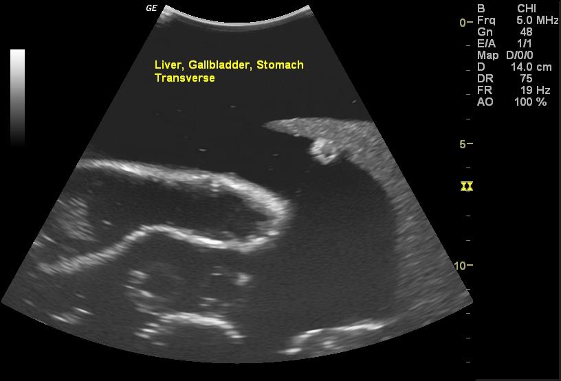 Adult Torso for X-Ray CT and US - Erler-Zimmer FLU02, view 12