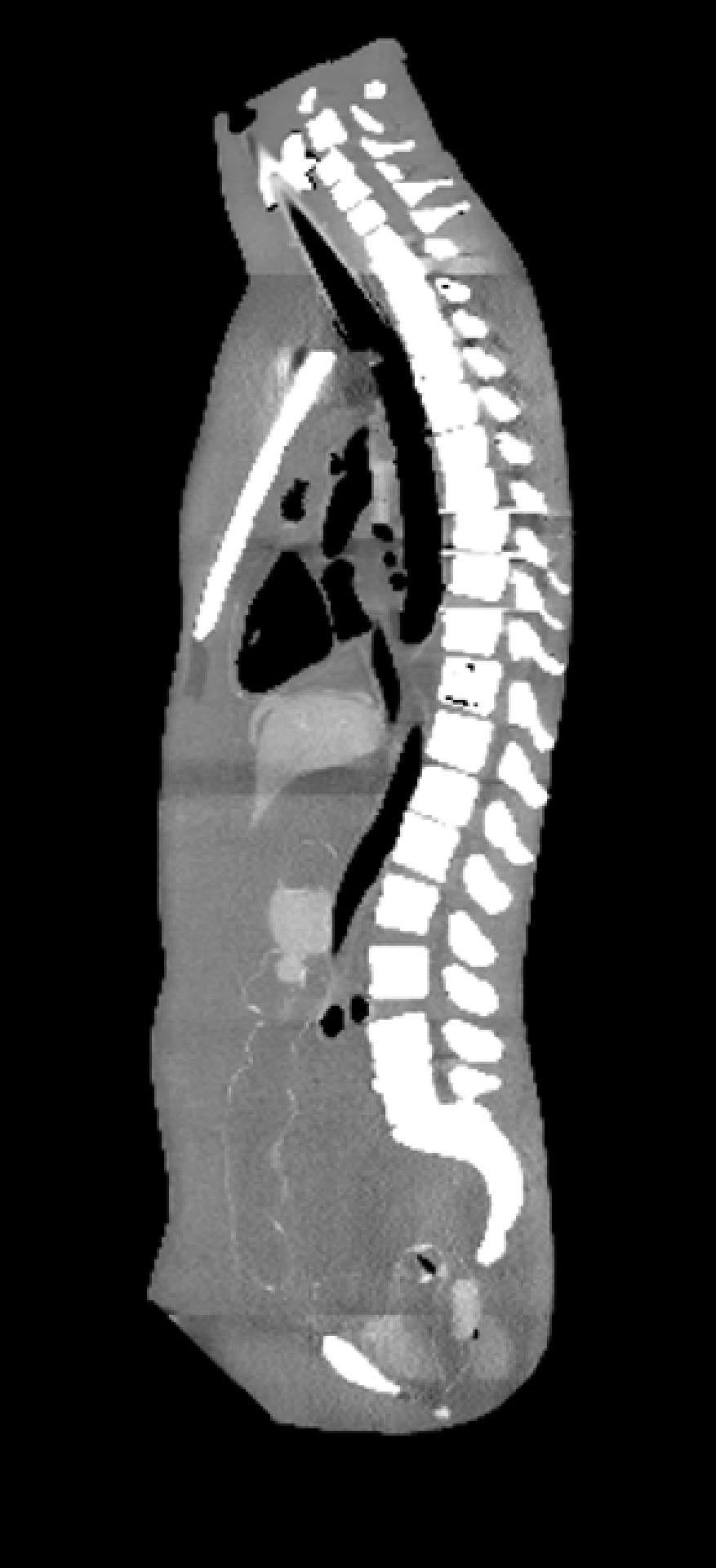 Adult Torso for X-Ray CT and US - Erler-Zimmer FLU02, view 4