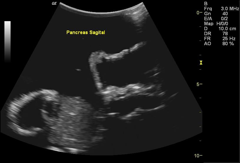 Adult Torso for X-Ray CT and US - Erler-Zimmer FLU02, view 6