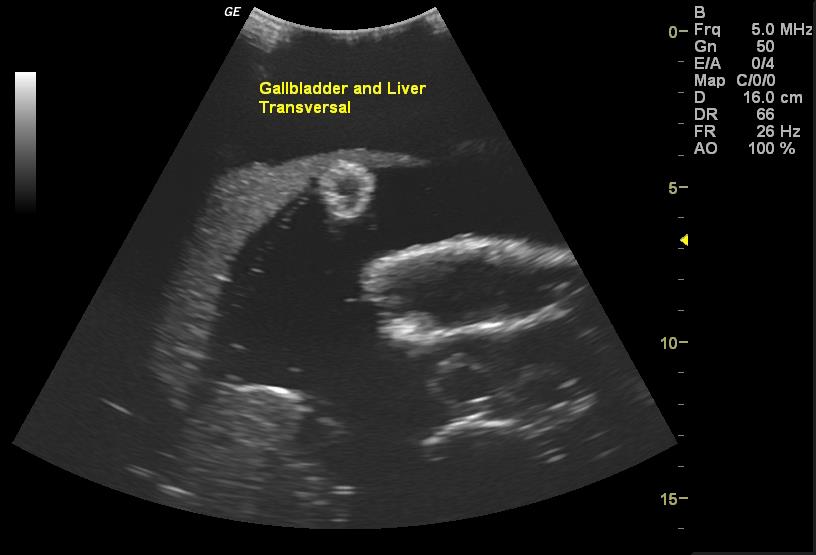 Adult Torso for X-Ray CT and US - Erler-Zimmer FLU02, view 7