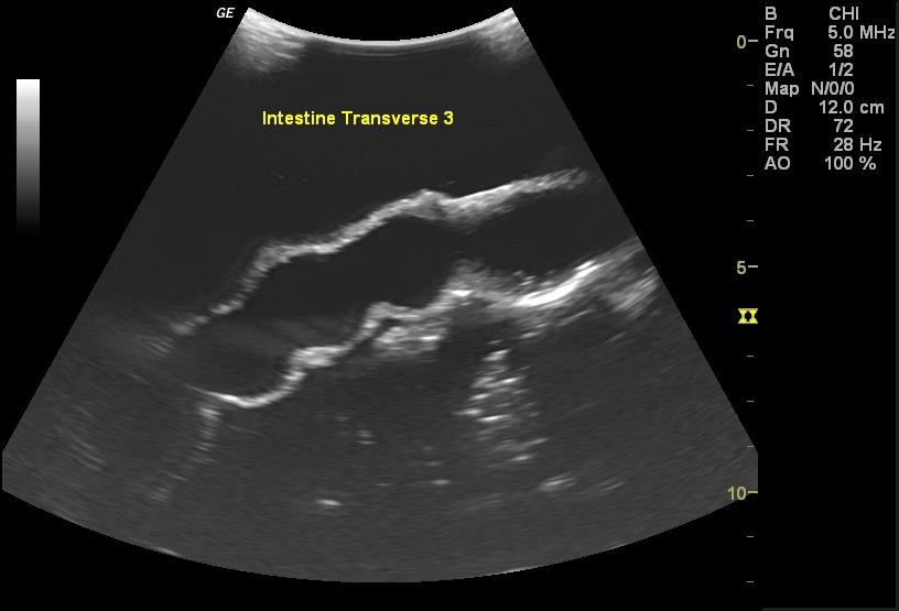 Adult Torso for X-Ray CT and US - Erler-Zimmer FLU02, view 9