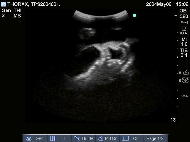 Adult Thorax for X-Ray CT and US - Erler-Zimmer FLX02, view 4
