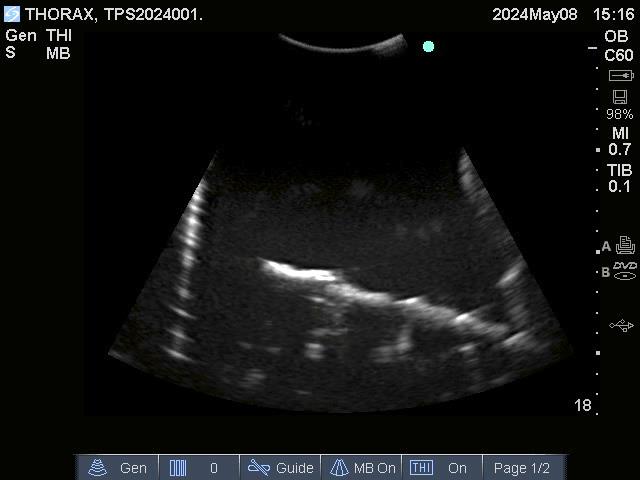 Adult Thorax for X-Ray CT and US - Erler-Zimmer FLX02, view 5