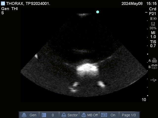 Adult Thorax for X-Ray CT and US - Erler-Zimmer FLX02, view 6