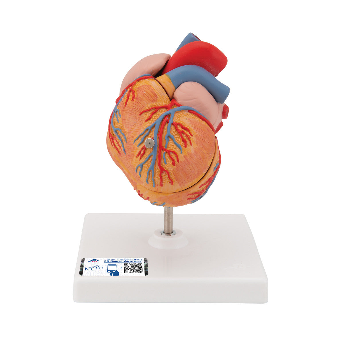 Classic Human Heart Model with Left Ventricular Hypertrophy (LVH), 2 part - 3B Smart Anatomy - G04