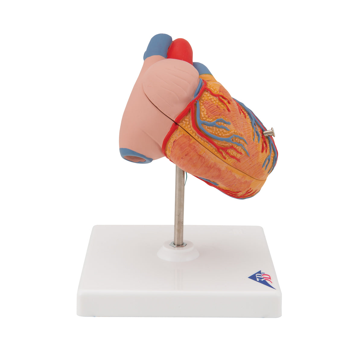 Classic Human Heart Model with Left Ventricular Hypertrophy (LVH), 2 part - 3B Scientific G04, view 9