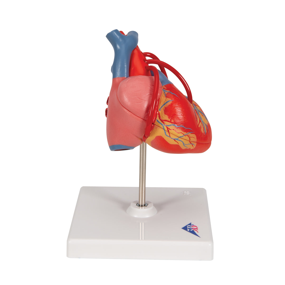 Heart Model with Bypass