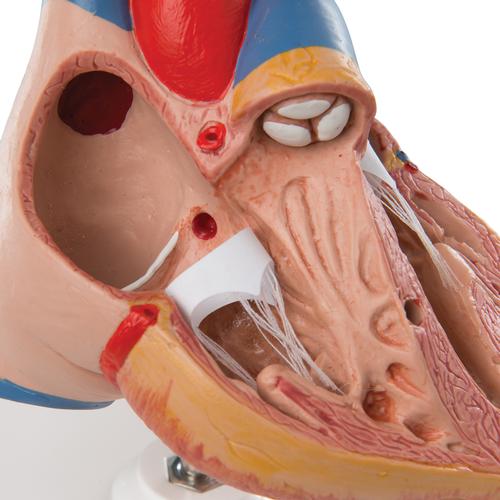 Classic Human Heart Model with Thymus, 3-Part - 3B Scientific G08/1, view 8