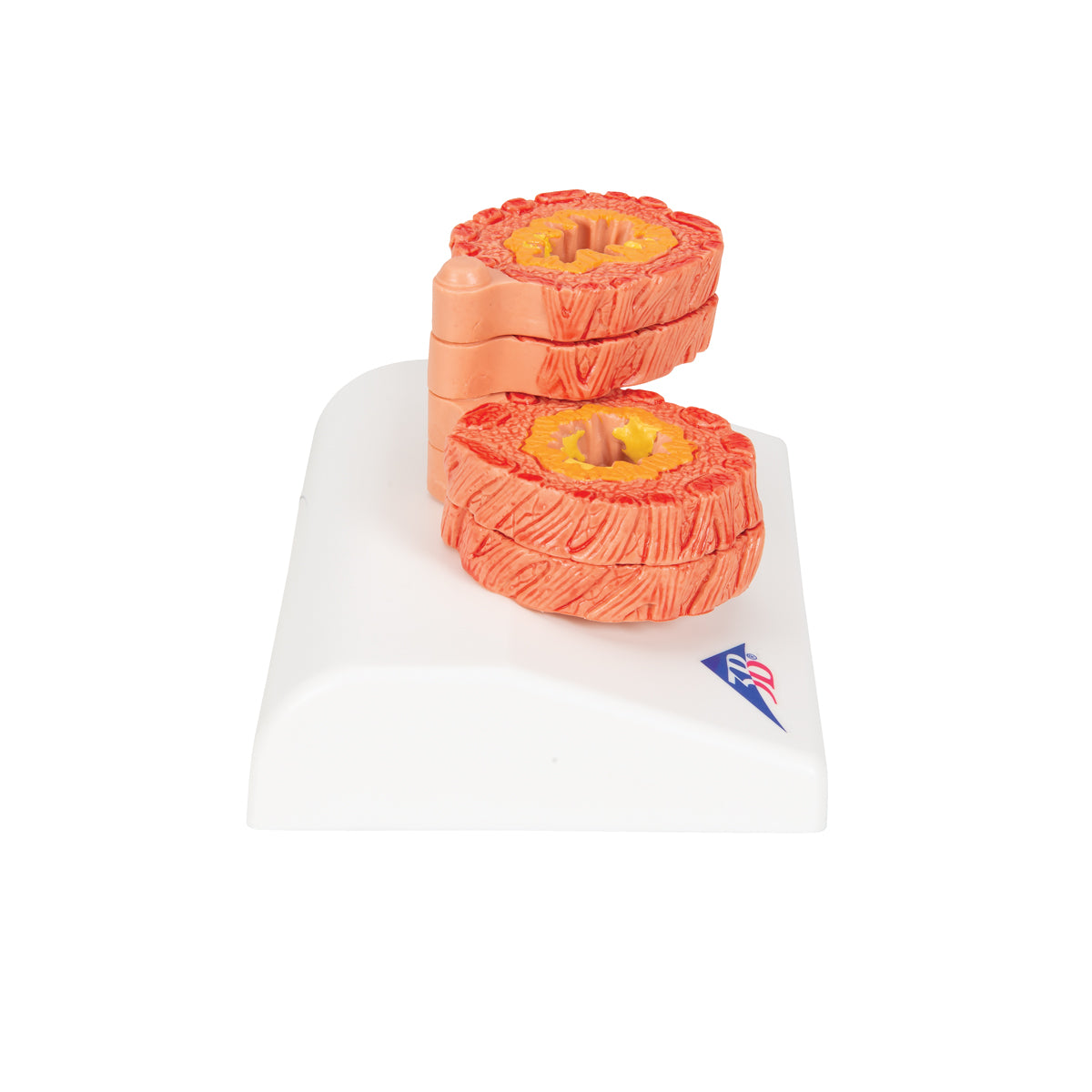 COPD Bronchial Tissue Model