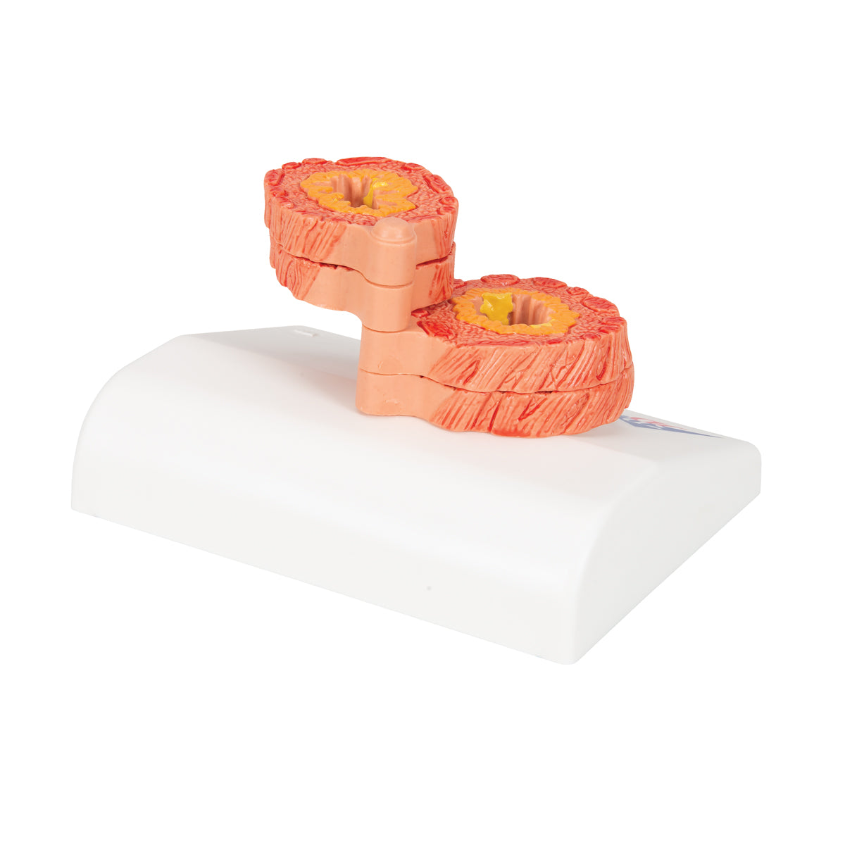 COPD Bronchial Tissue Model