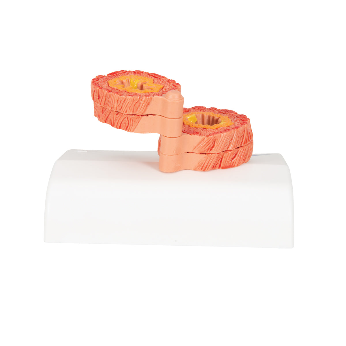 COPD Bronchial Tissue Model