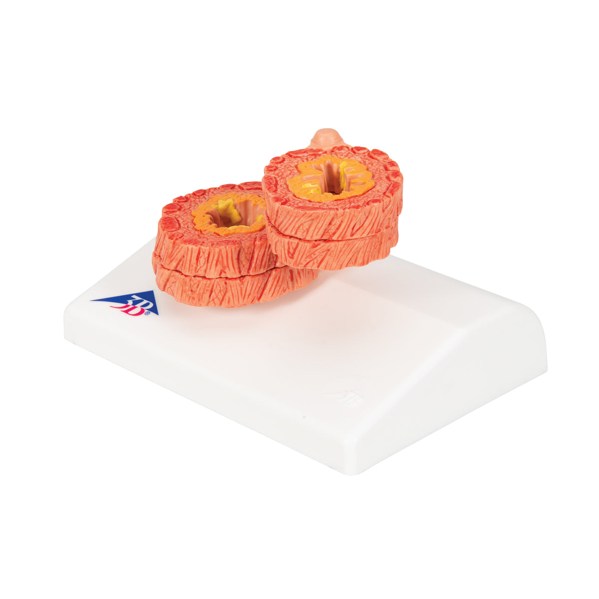 COPD Bronchial Tissue Model