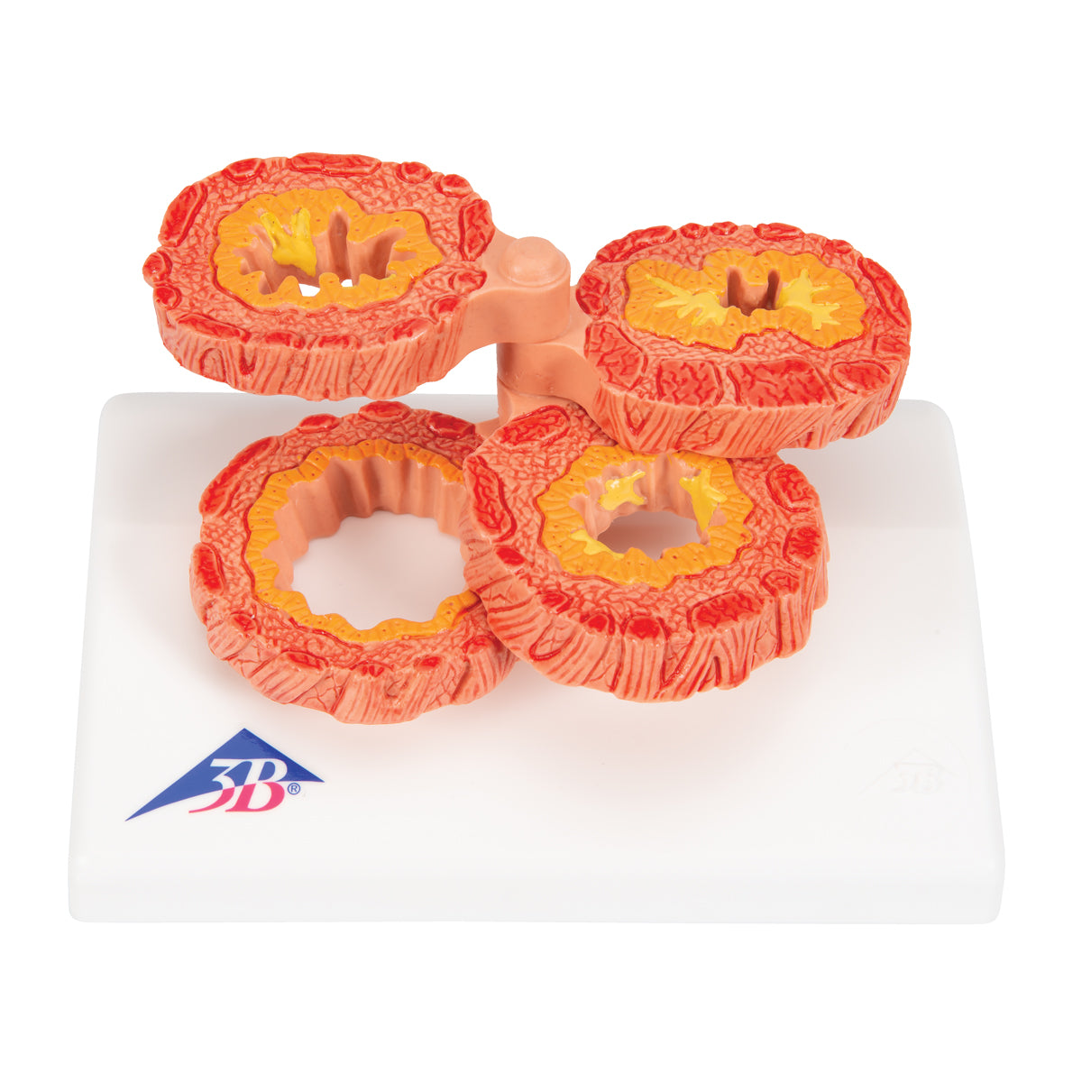 COPD Bronchial Tissue Model