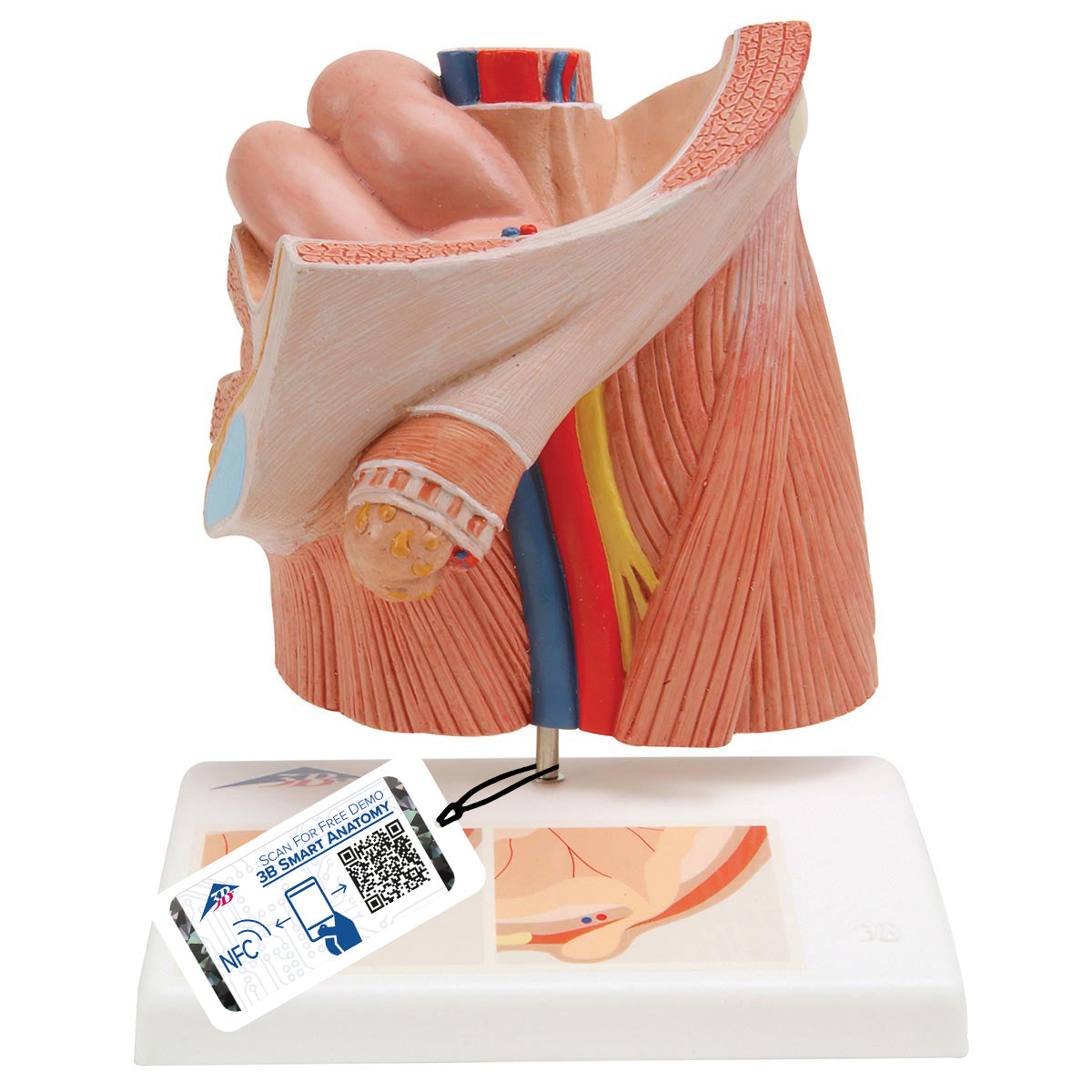 Inguinal Hernia Urology Model