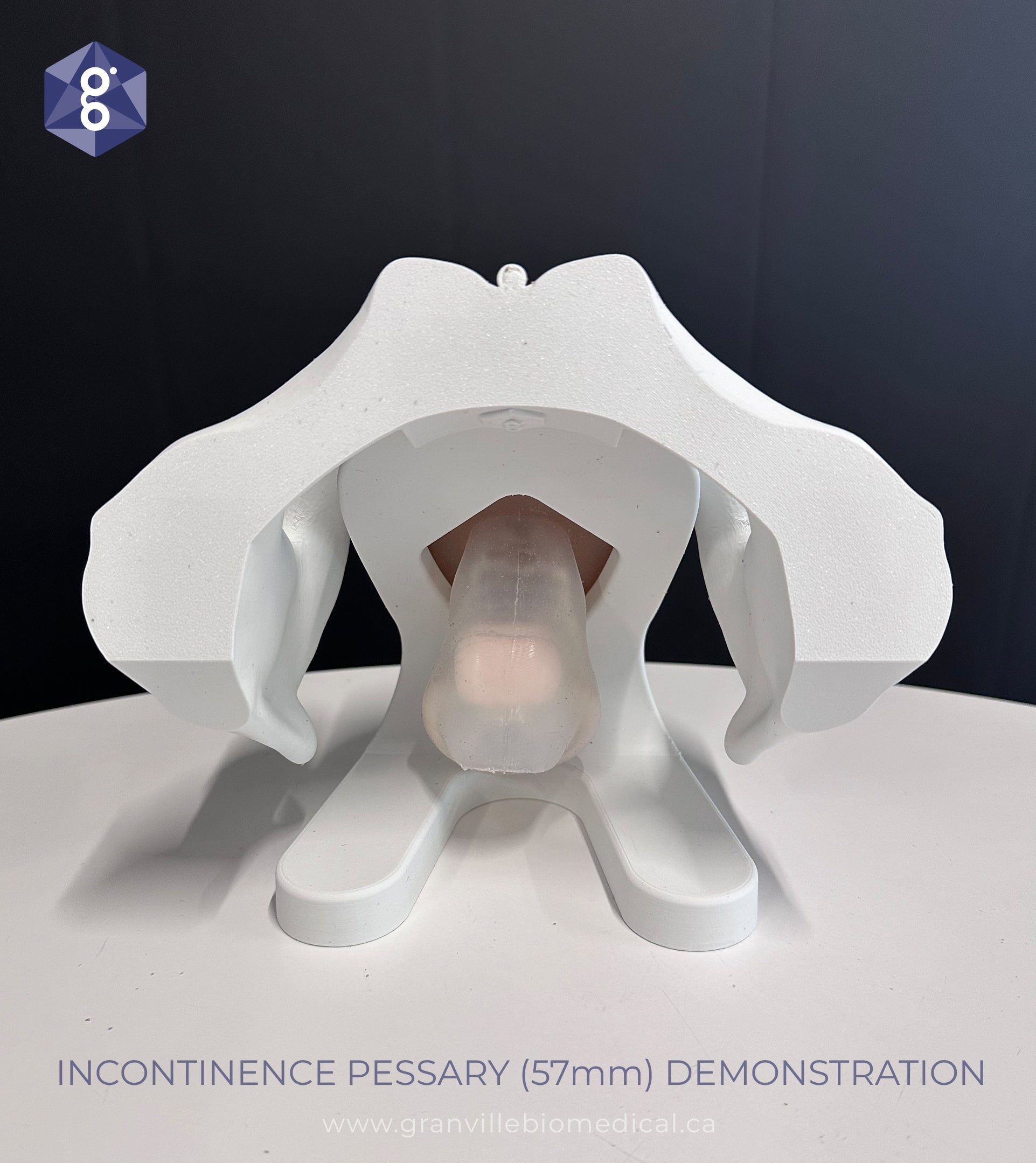 Iris model demonstrating incontinence ring pessary fitting