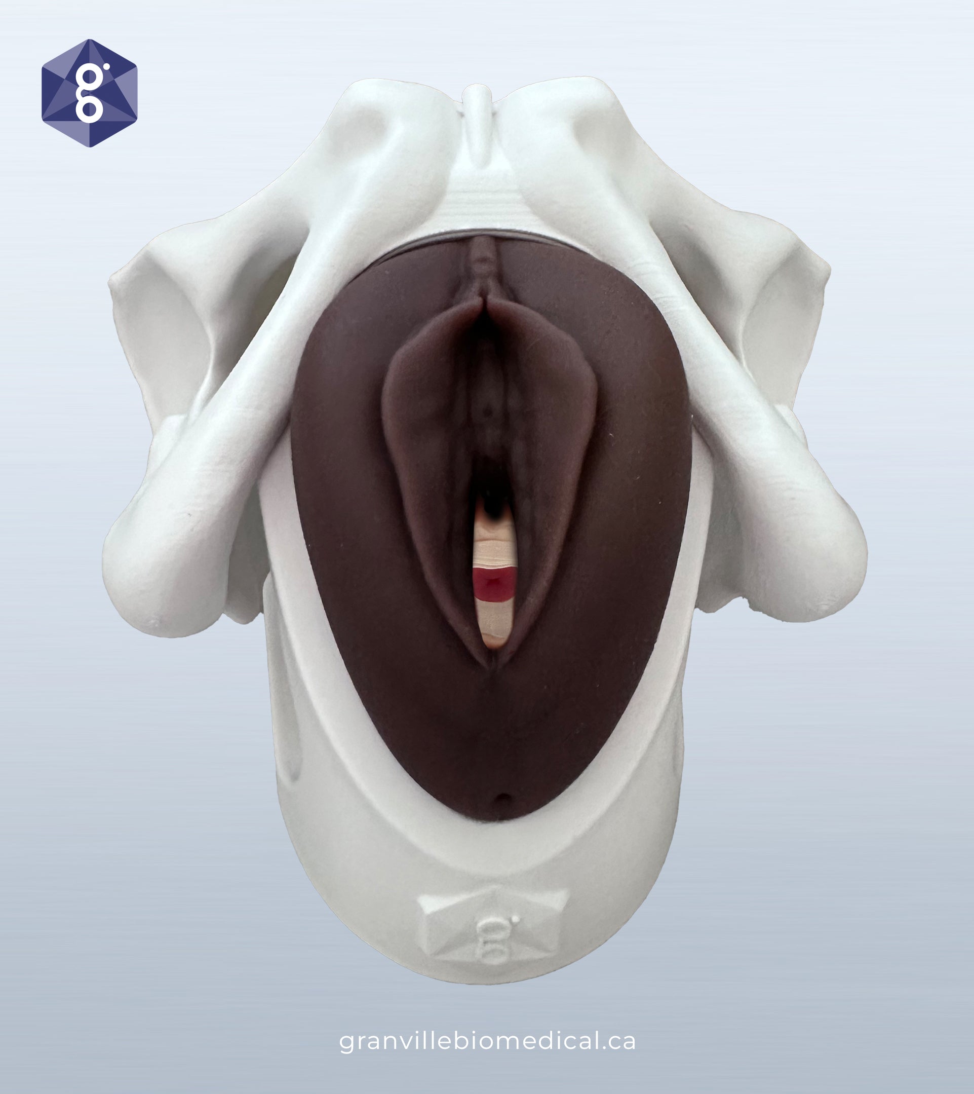 Iris pessary demonstration model in dark skin tone