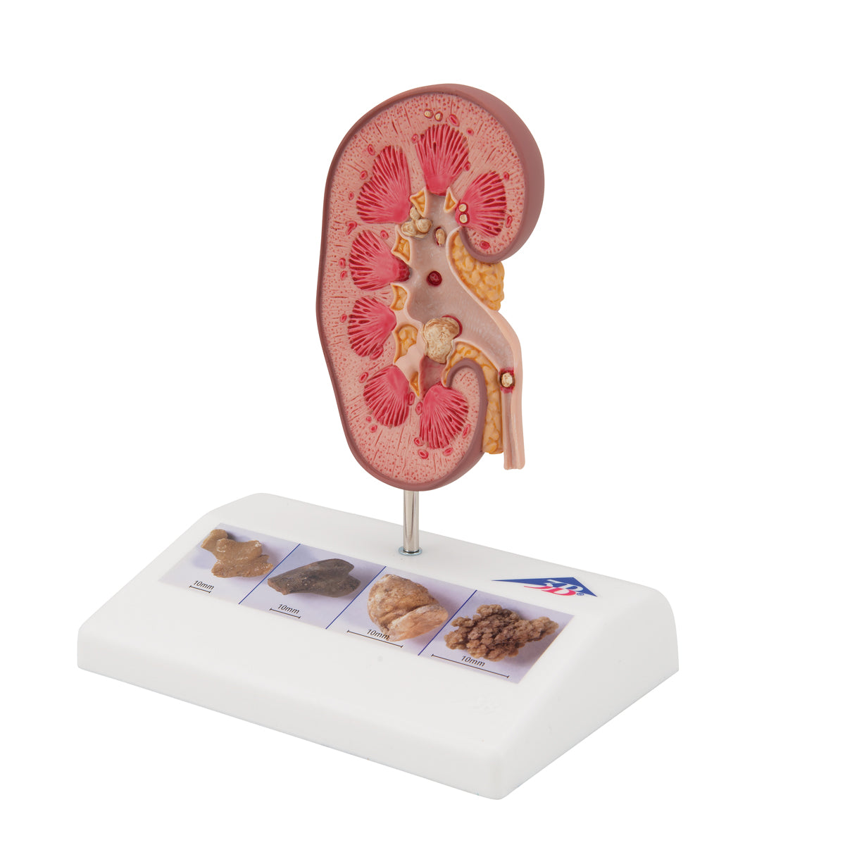 Kidney Stone Model - 3B Scientific K29, view 13