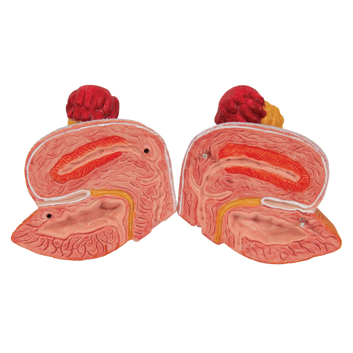Dual Sex Urinary System Model, 6 part