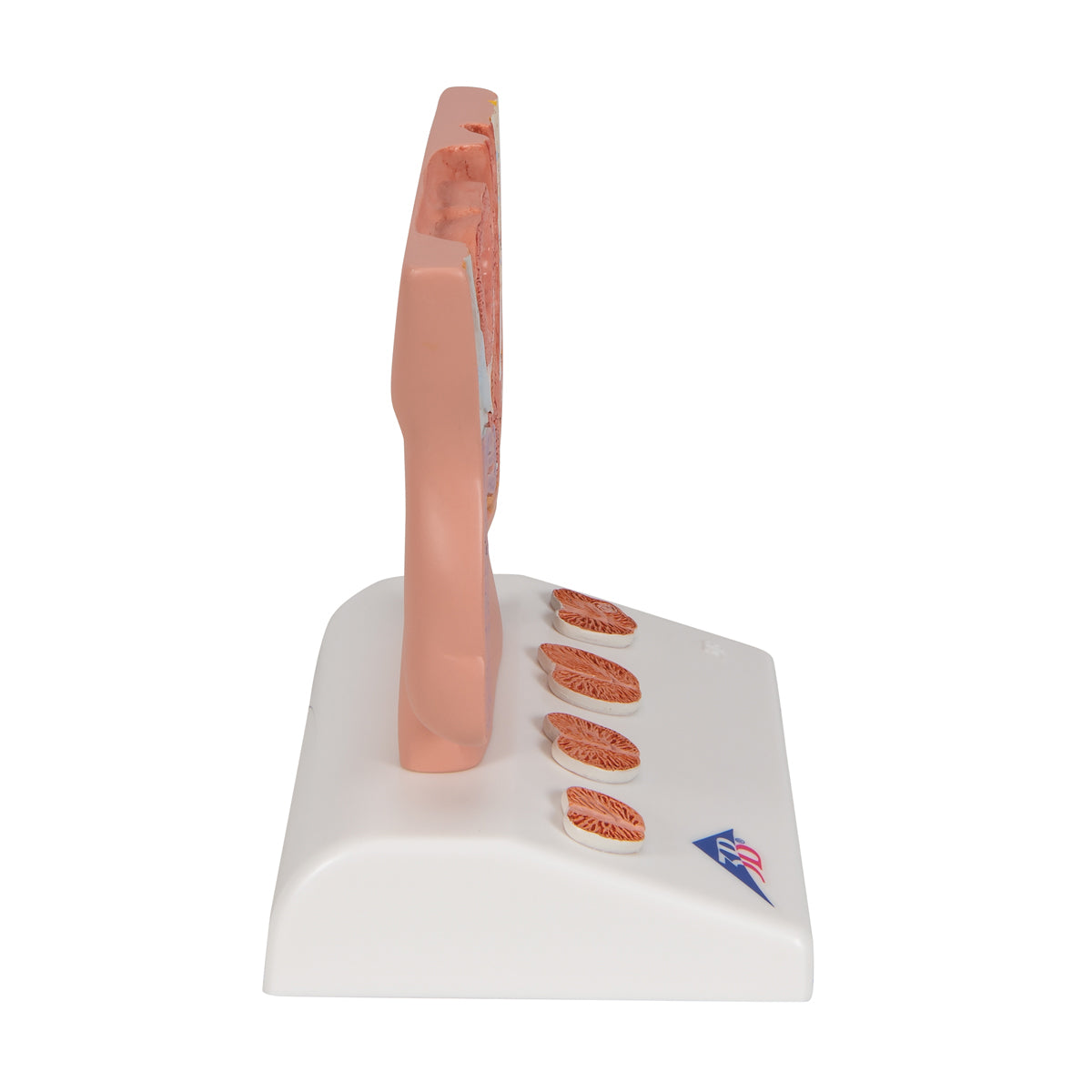 Prostate Model, 1/2 Natural Size