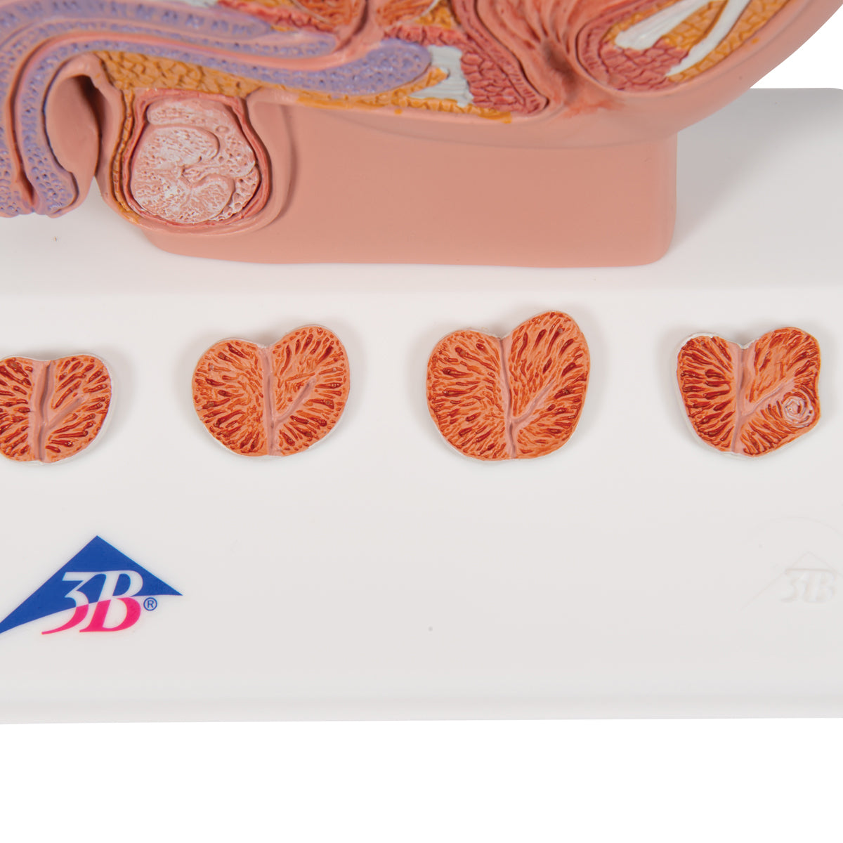 Prostate Model, 1/2 Natural Size