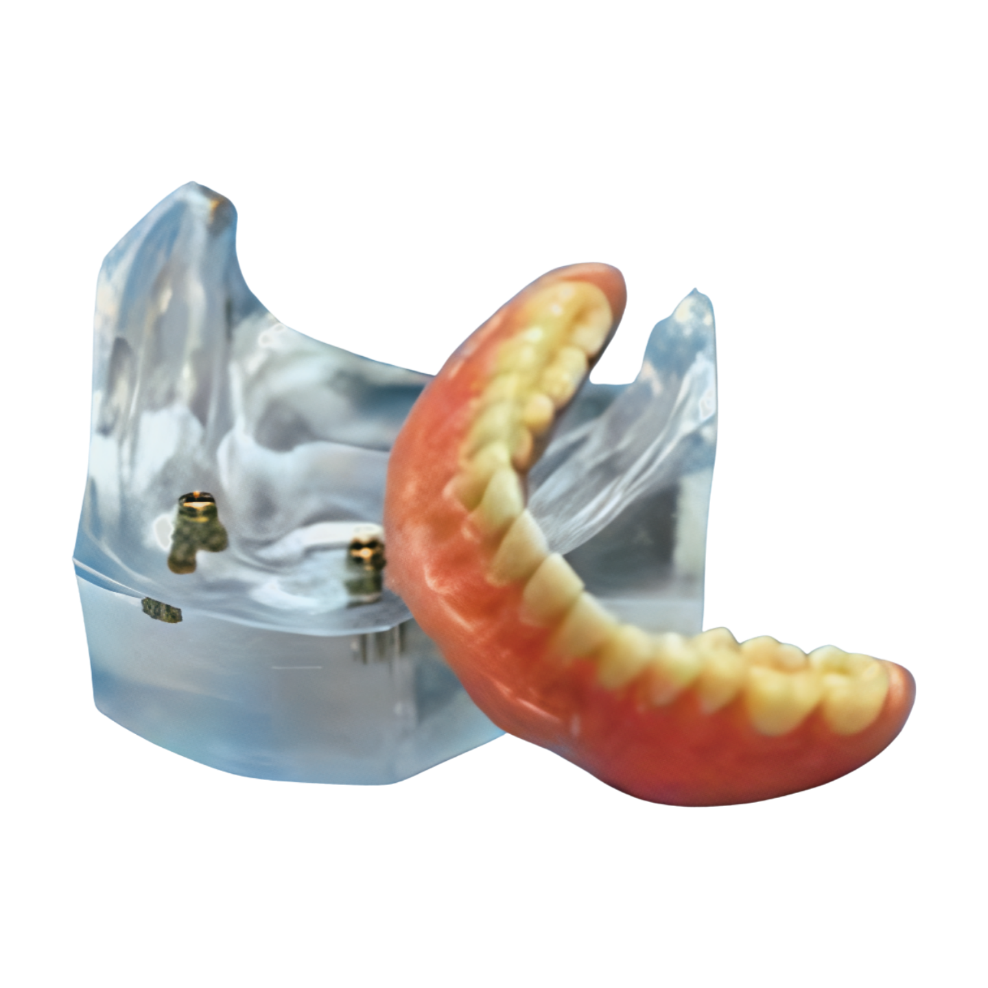 KPEK – Kilgore Patient Education Kit