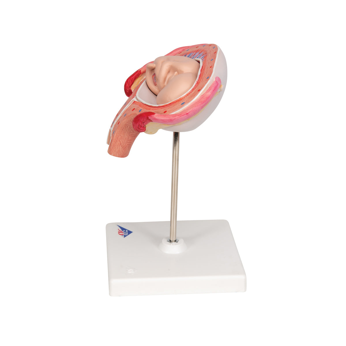 Fetus Model, 4th Month in Abdominal Position
