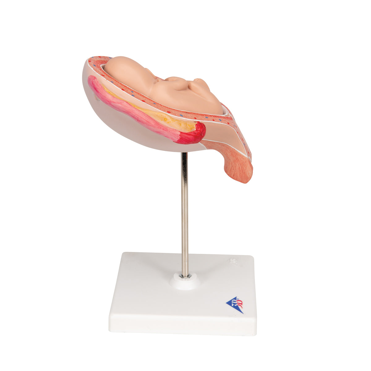 Fetus Model, 5th Month in Breech Position