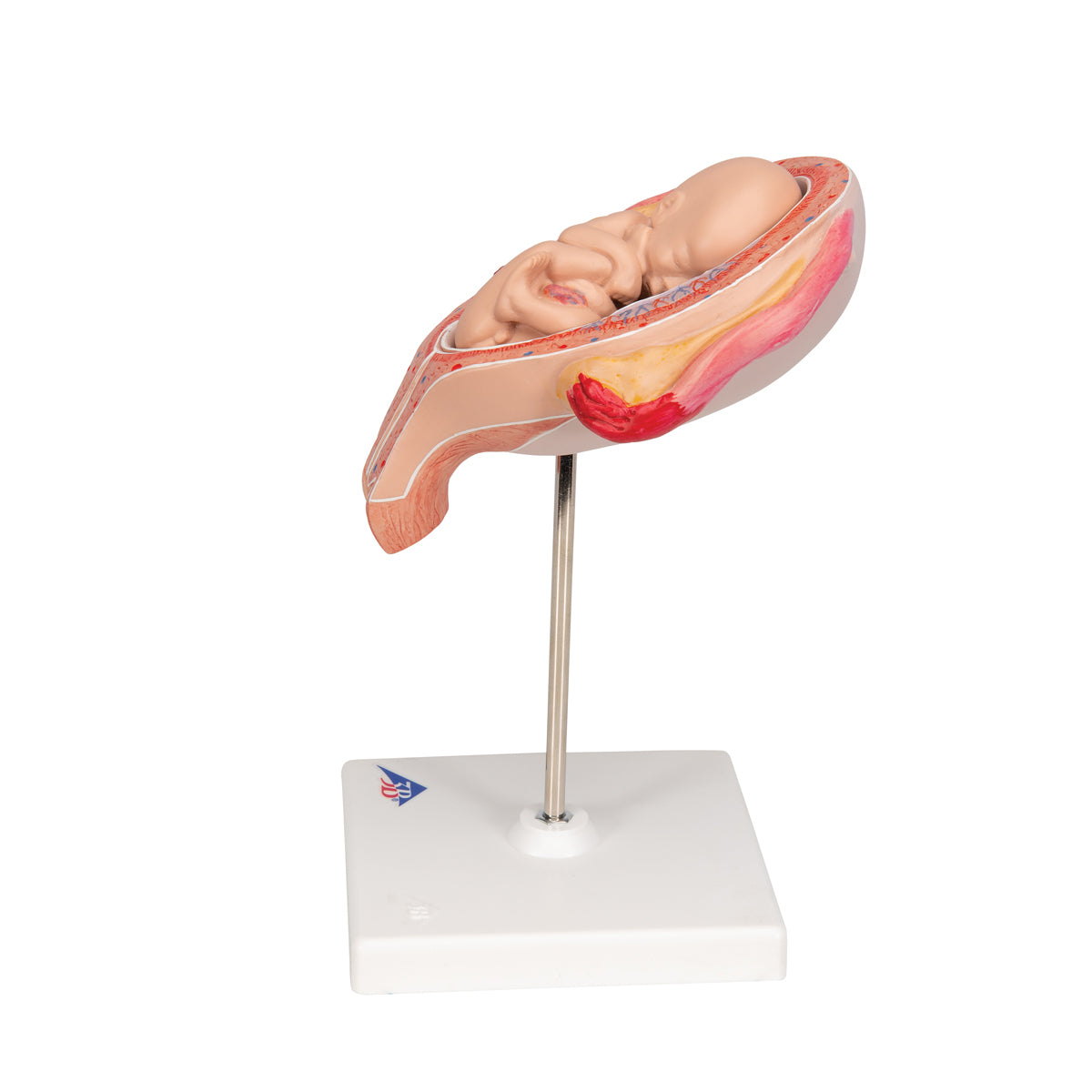 Fetus Model, 5th Month in Breech Position