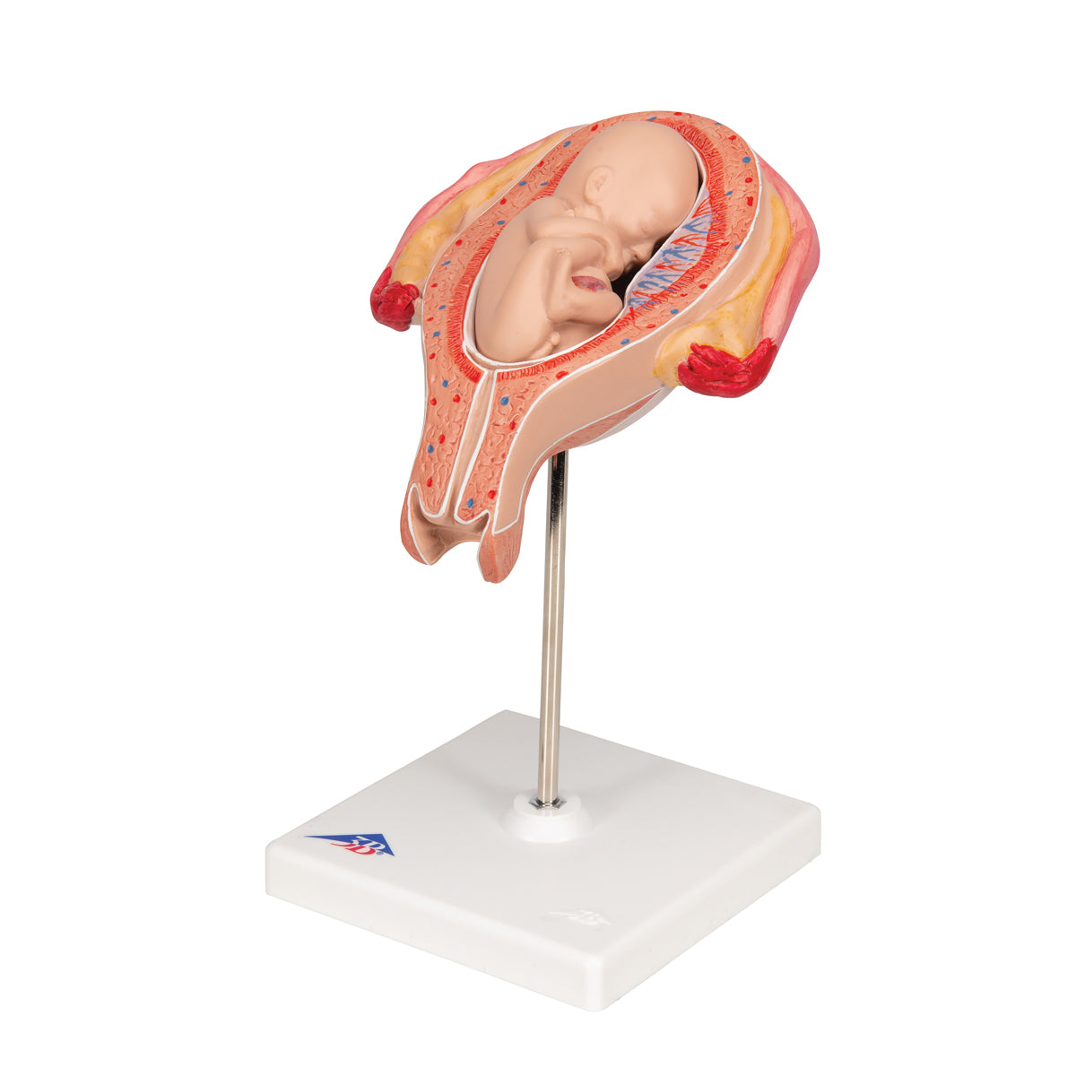 Fetus Model, 5th Month in Breech Position