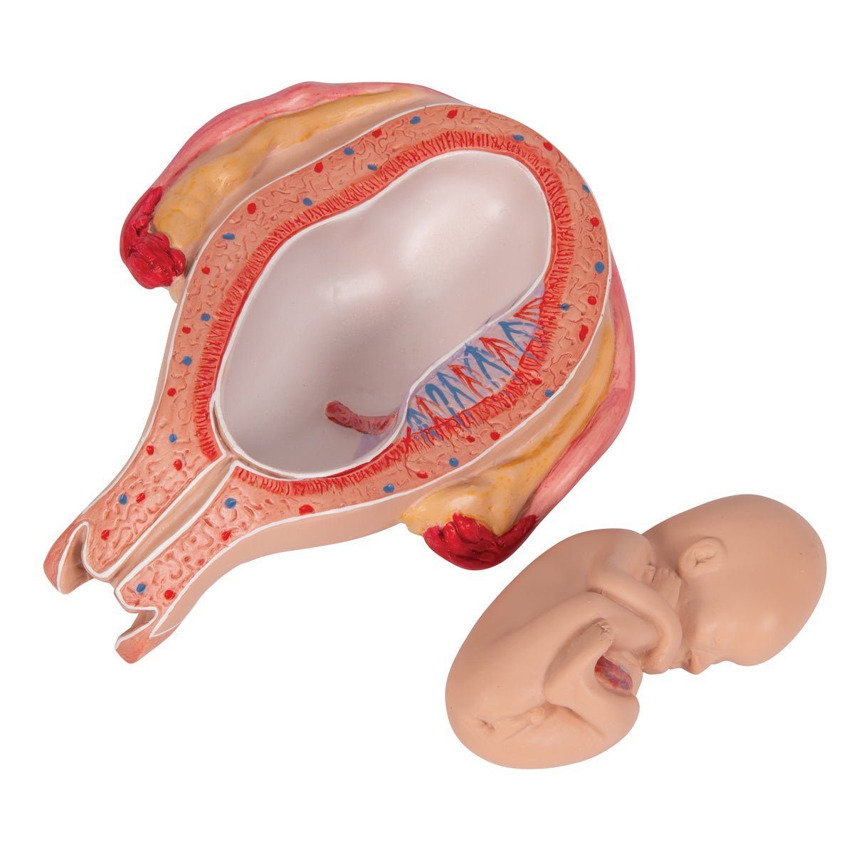Fetus Model, 5th Month in Breech Position